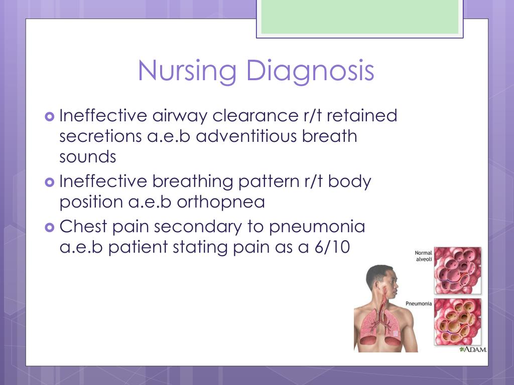 Ppt Community Acquired Pneumonia Powerpoint Presentation Free Download Id 1939980