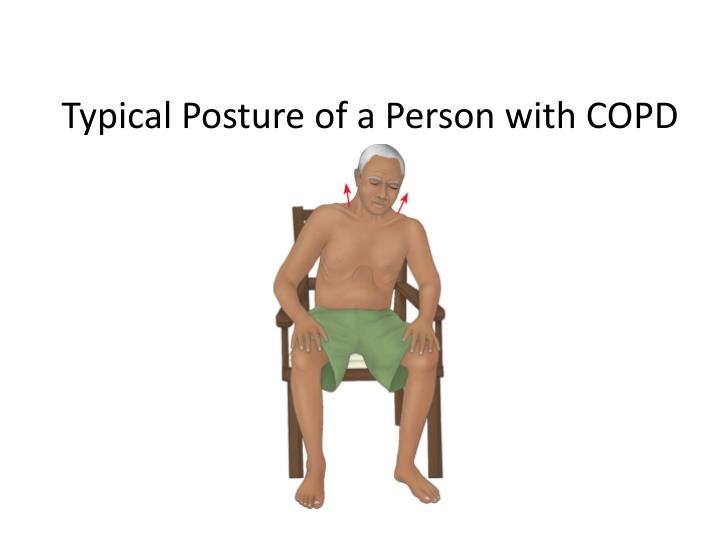 PPT - Management of Patients With Chest and Lower 