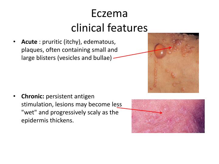 PPT - Skin Pathology PowerPoint Presentation - ID:1942011