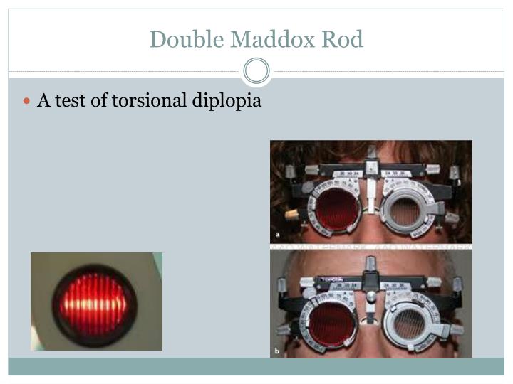 PPT Strabismus What you need to ask and know PowerPoint Presentation