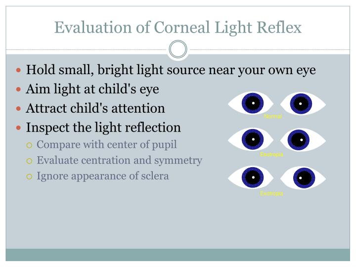 PPT Strabismus What you need to ask and know PowerPoint Presentation PPT Strabismus What you need to ask and know PowerPoint Presentation