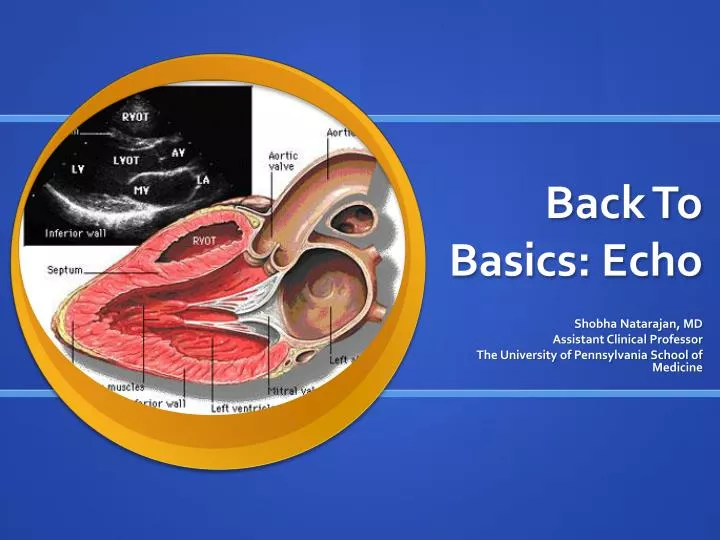 PPT Back To Basics Echo PowerPoint Presentation Free Download ID 