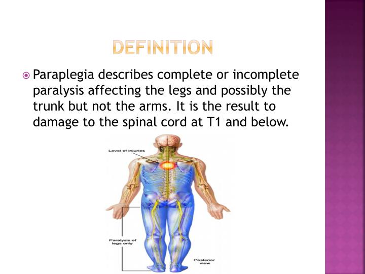 Paraplegia visual data 4