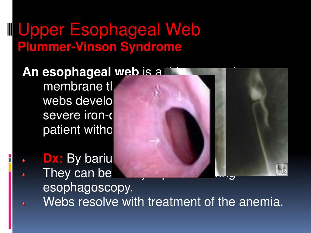 Esophageal Diseases | SpringerLink