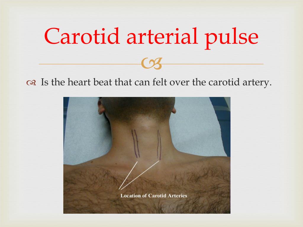 carotid pulse