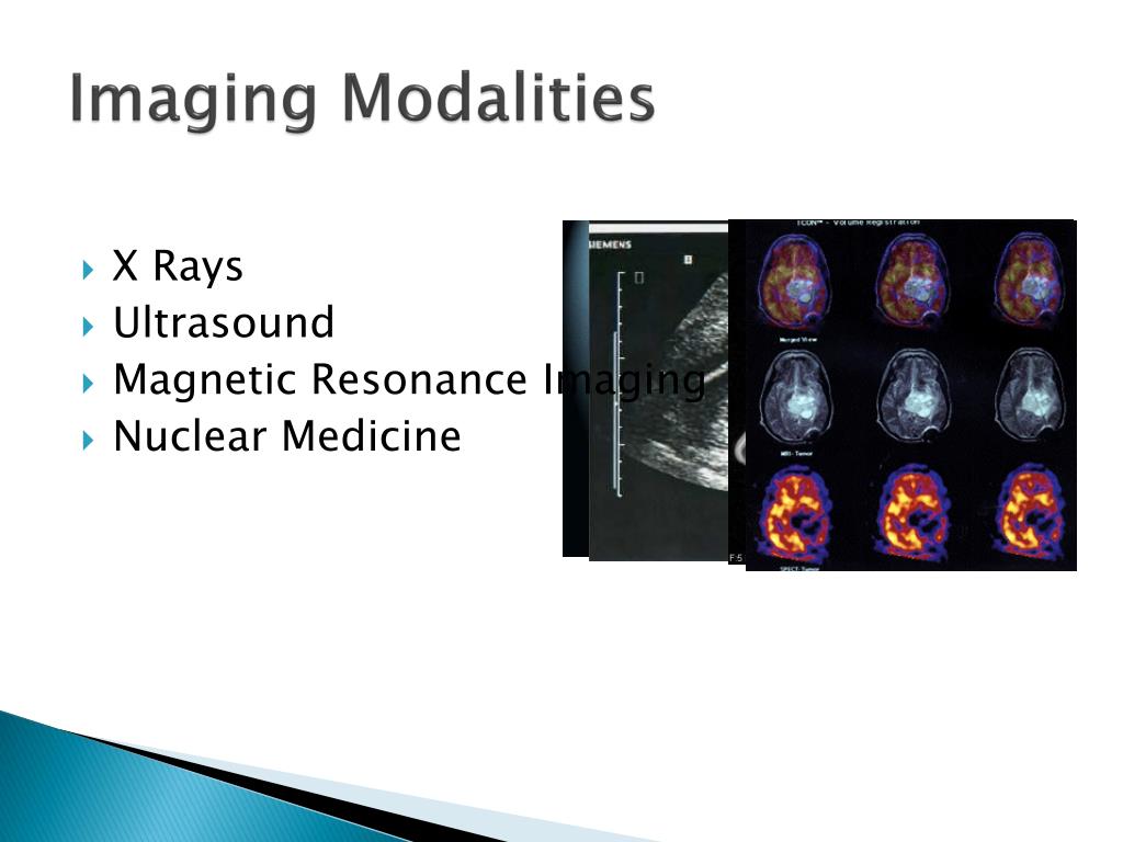 PPT Imaging Methods in Monitoring and Diagnosis PowerPoint