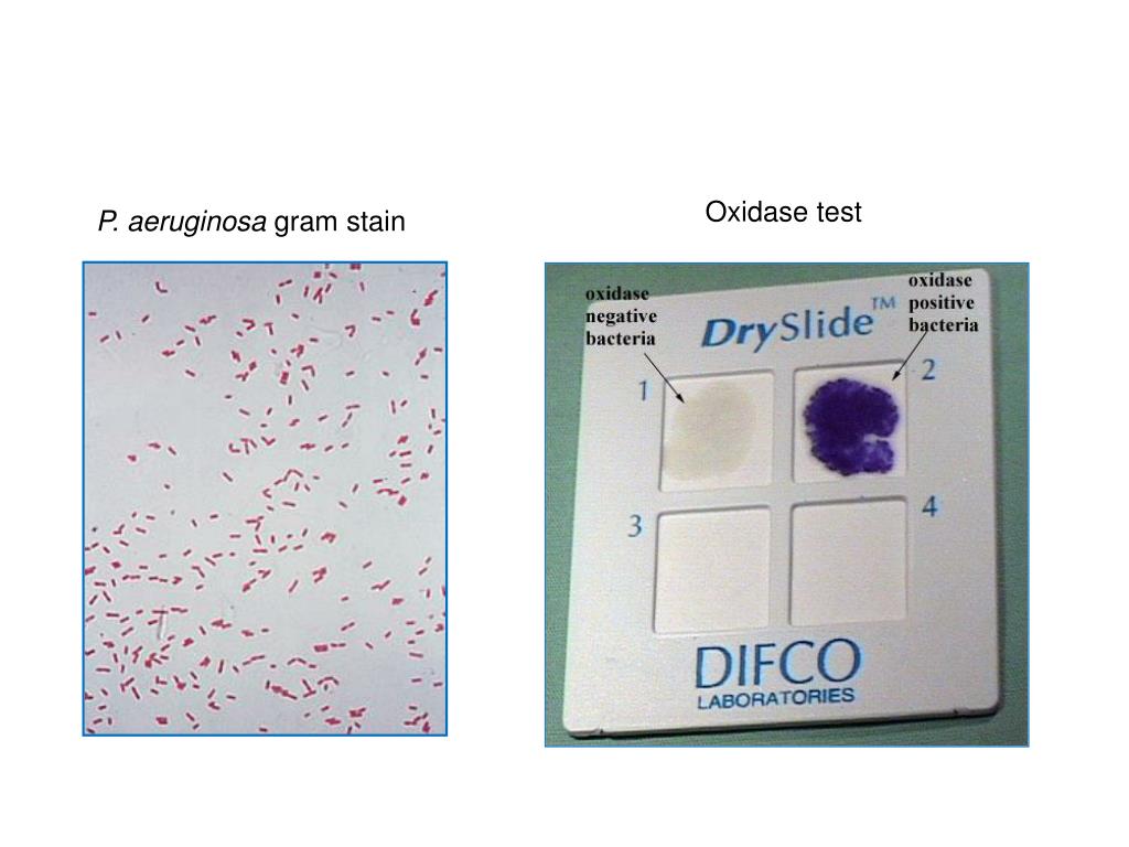 PPT Pseudomonas and other related genera PowerPoint Presentation PPT Pseudomonas and other related genera PowerPoint Presentation