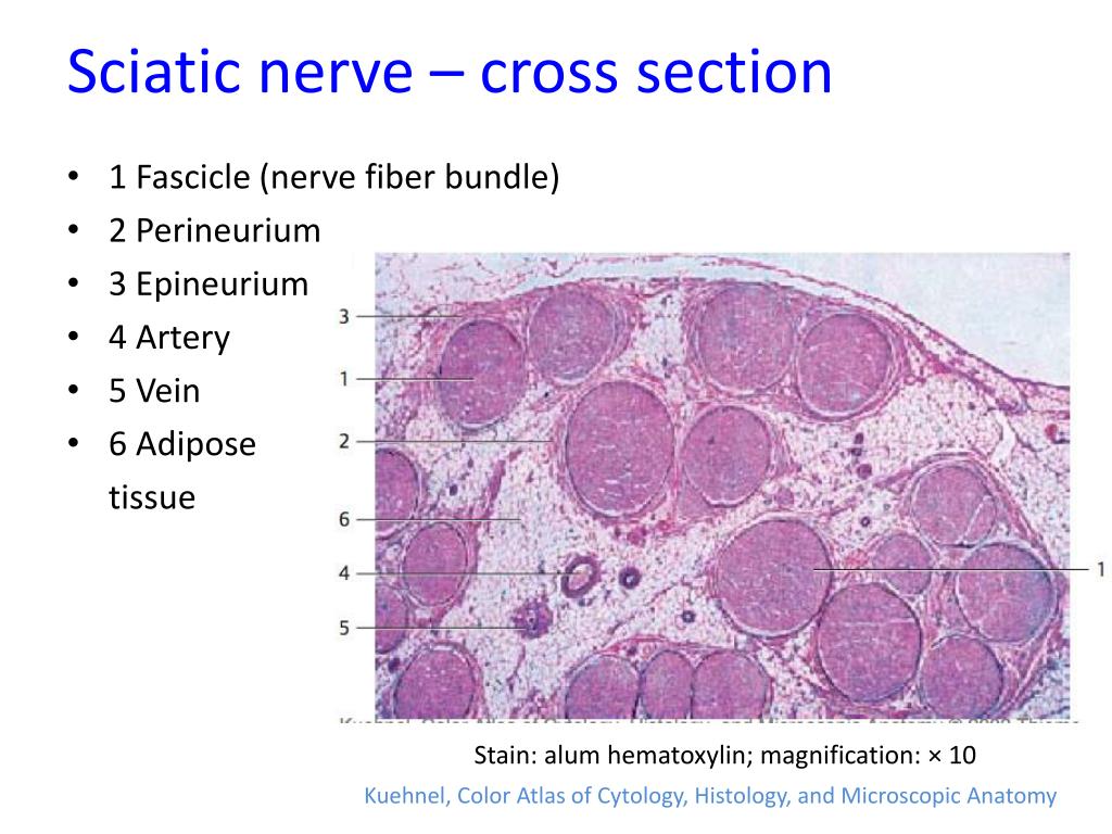 Nerve Cross Section Slide Labeled