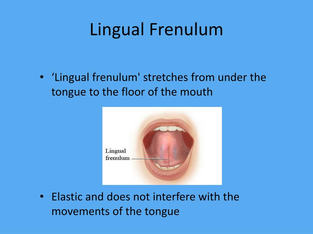 Ppt Impact On Breastfeeding Of Restrictive Lingual Frenulum Powerpoint Presentation Id1952564 
