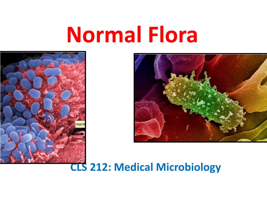 PPT Normal Flora PowerPoint Presentation Free Download ID 1957631