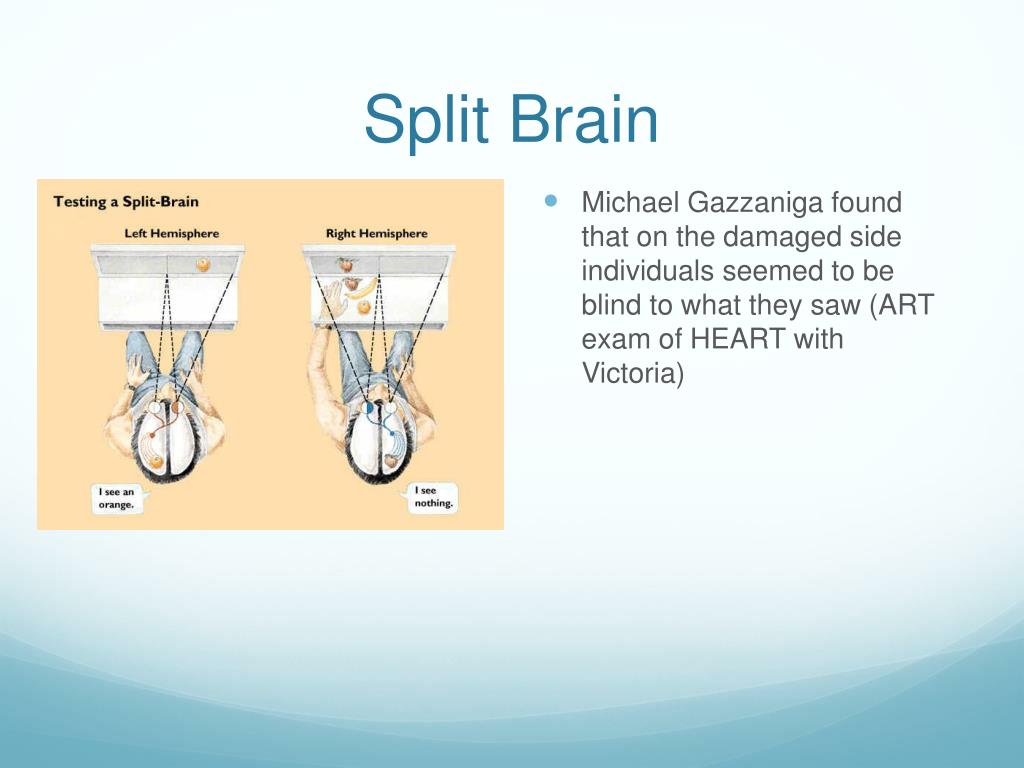 Split brain