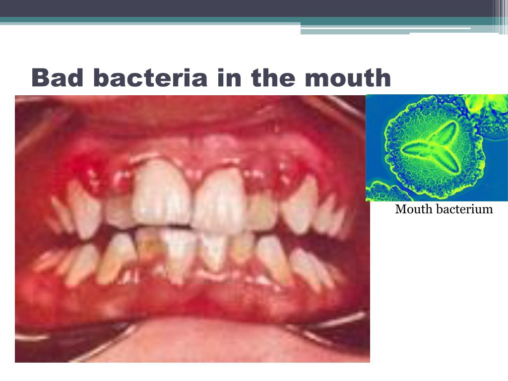 Ppt 8c Microbes And Disease Powerpoint Presentation Free Download