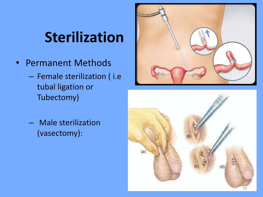 sterilization.