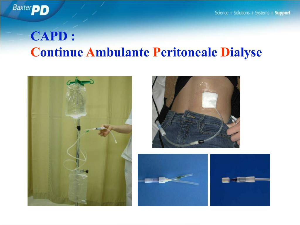PPT - Basisbegrippen Peritoneale Dialyse AZ St-Jan Brugge 17 september 2012  PowerPoint Presentation - ID:1973591