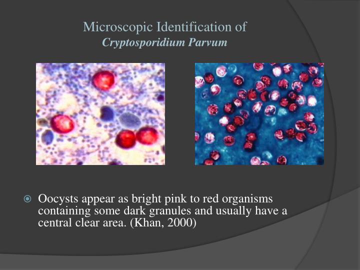 PPT - Cryptosporidium PowerPoint Presentation - ID:1978236