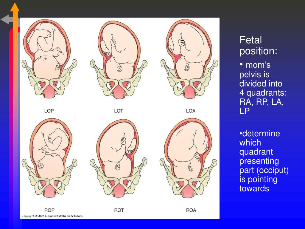 what is cephalic presentation in pregnancy