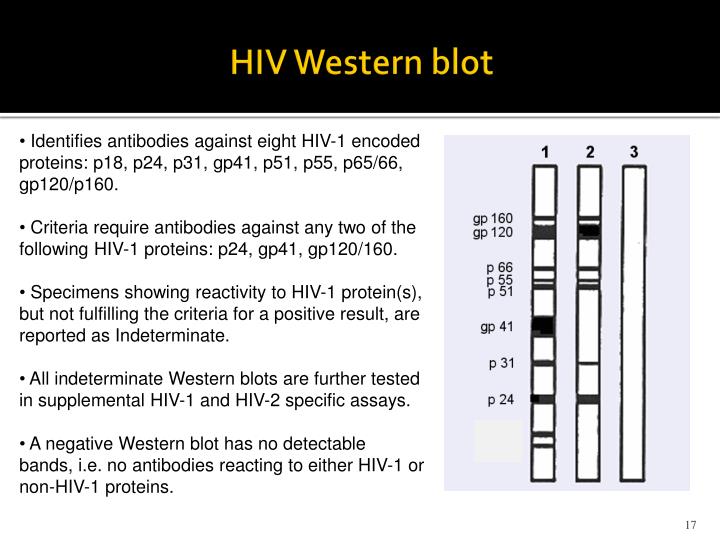 western blot technique hiv