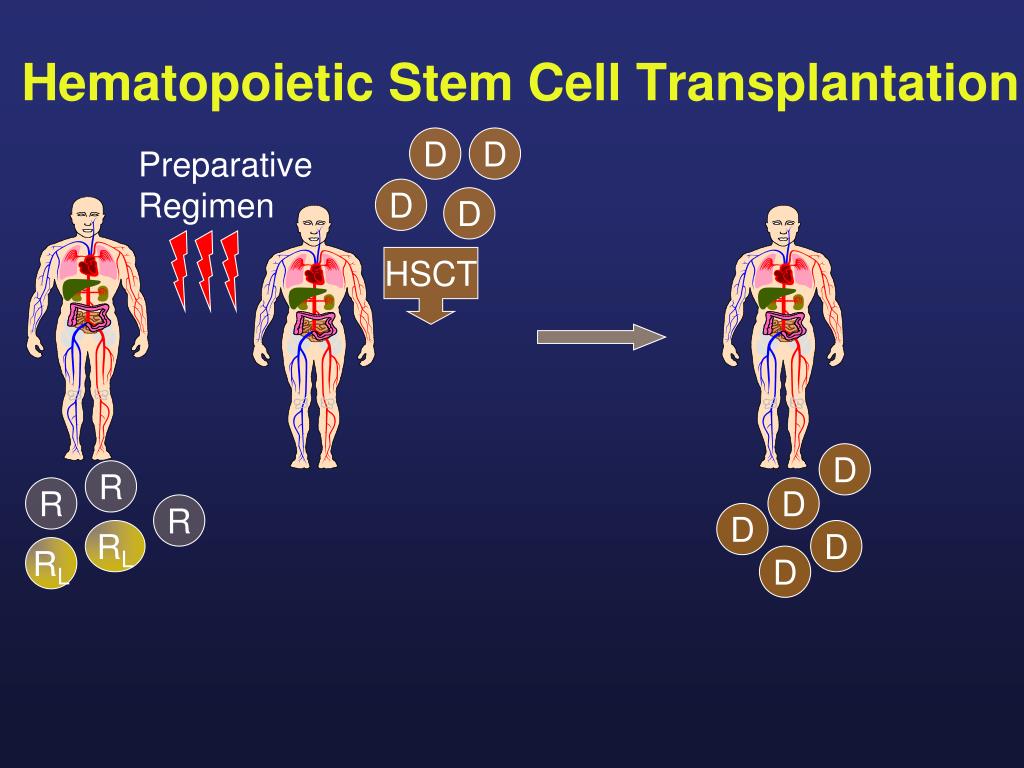 PPT Cellular Immune Therapy with Allogeneic Stem Cell Transplantation