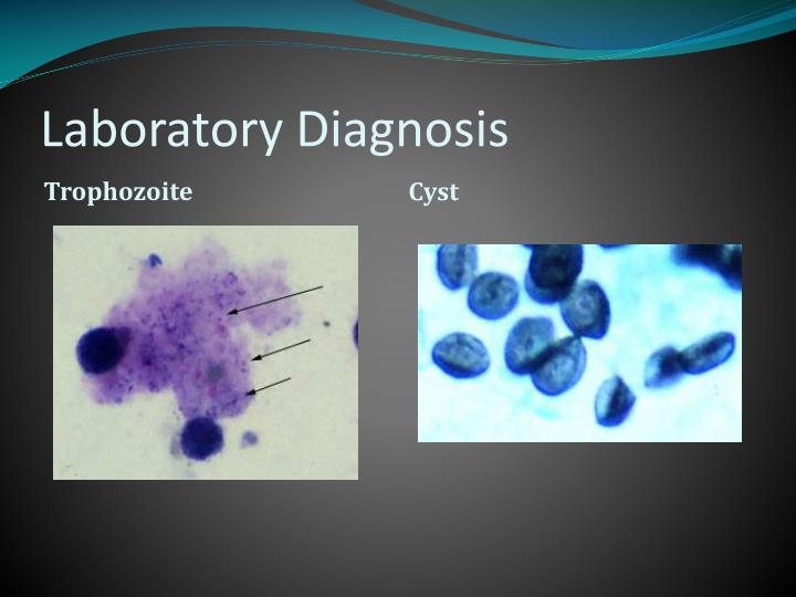 PPT - Pneumocystis carinii PowerPoint Presentation - ID:1988078