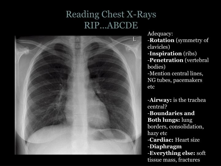PPT ASTHMA AND COPD PowerPoint Presentation ID1988928
