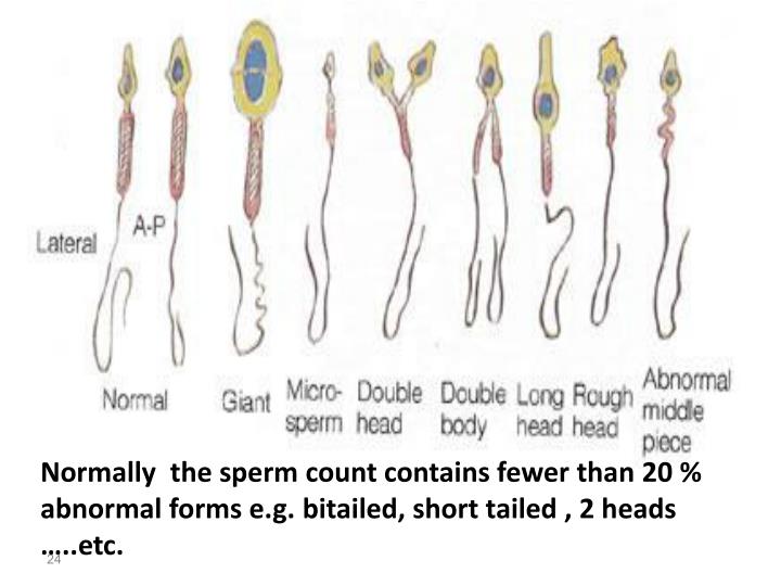 PPT - Semen Analysis PowerPoint Presentation - ID:1992878