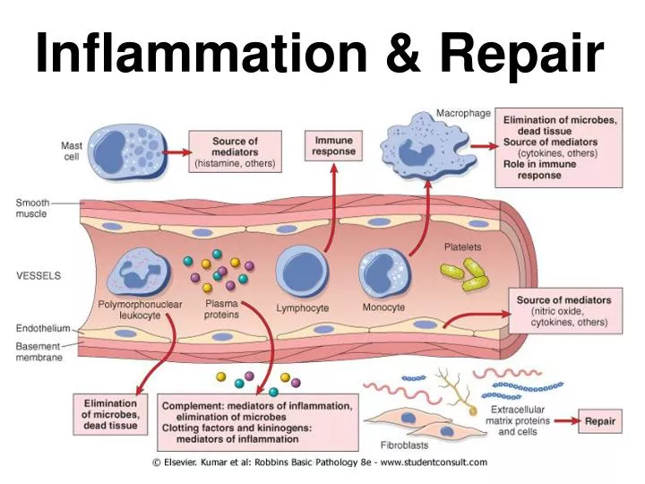 Inflammation Des Muscles Inflammation Des Muscles Sans Effort DMYDID Inflammation Des Muscles Inflammation Des Muscles Sans Effort DMYDID