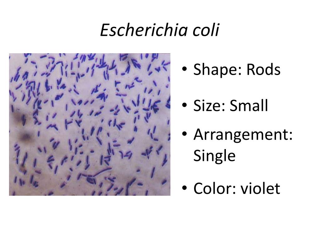 Escherichia coli что это у мужчин. Эшерихия коли норма. Escherichia coli рисунок. Эшерихии в мазке. Эшерихия коли в мазке.