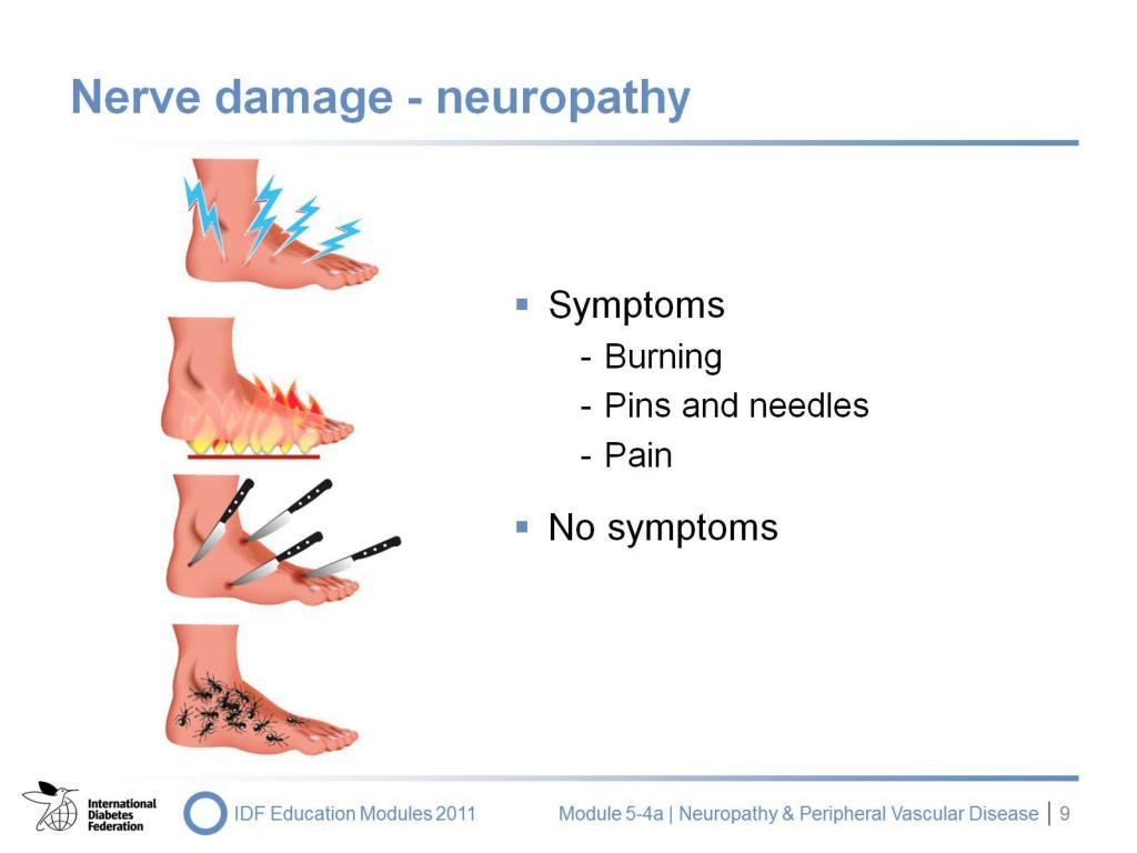 does pain during neuropathy emg test mean nerve damage does pain during neuropathy emg test mean nerve damage
