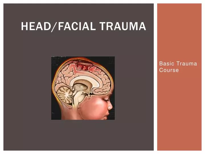 head facial trauma n.