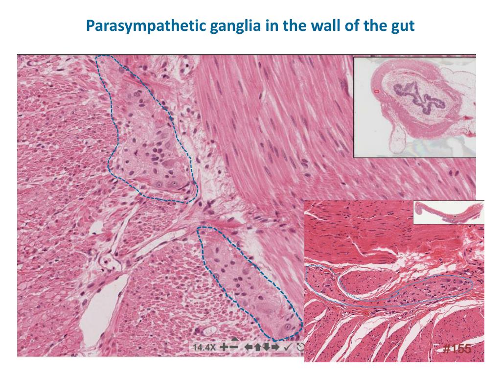 PPT - Histology of the Peripheral Nervous System PowerPoint