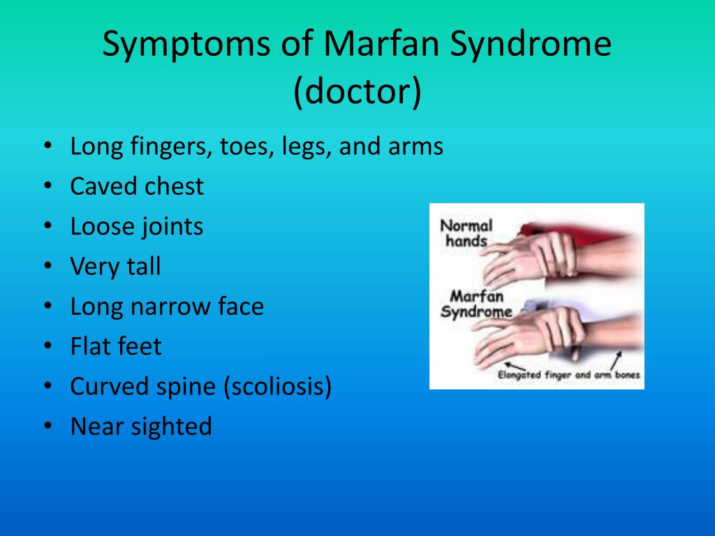 PPT - Marfan Syndrome PowerPoint Presentation, free download - ID:1996831