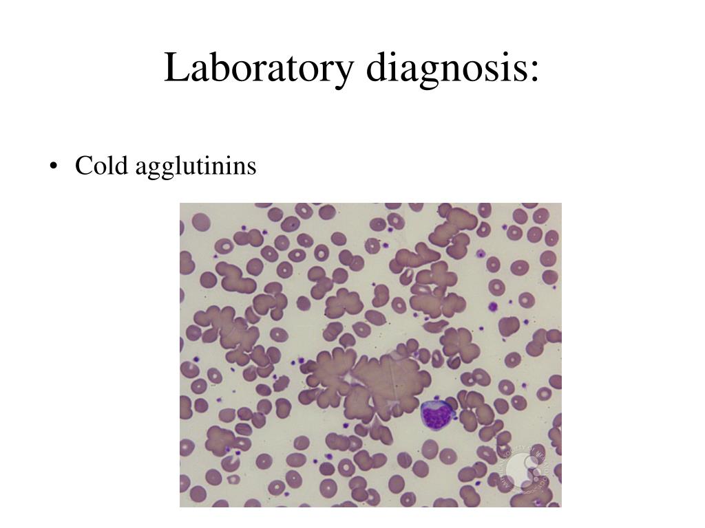 PPT - Infections of the lower respiratory tract PowerPoint Presentation ...