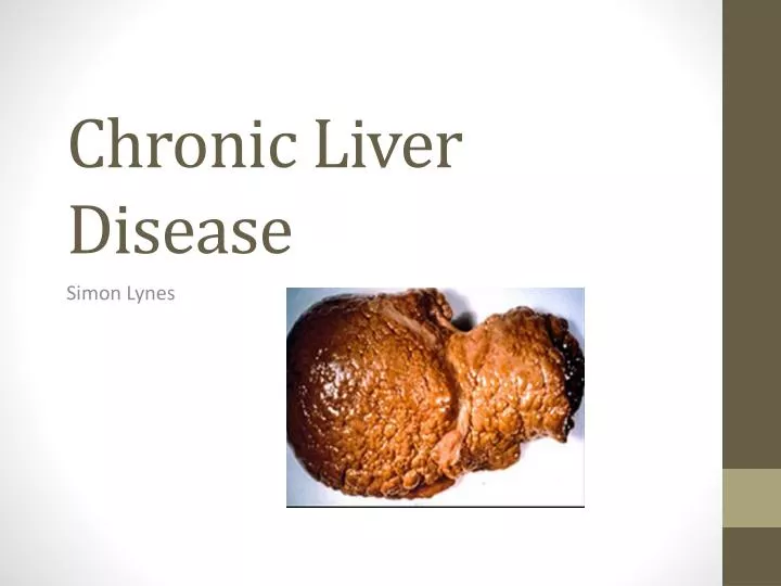 thesis topics on chronic liver disease