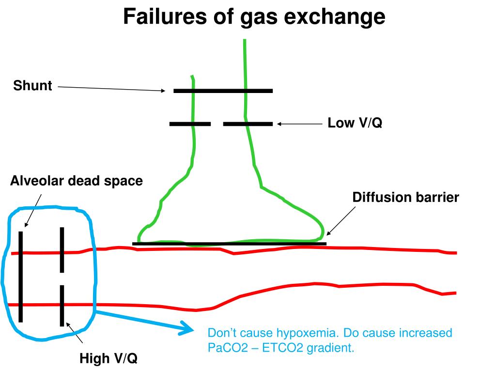 physiologicla shunt vs dead space physiologicla shunt vs dead space