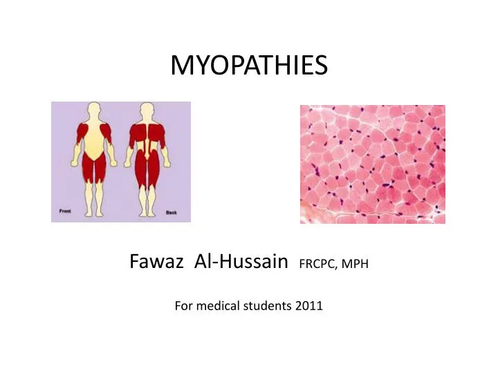 PPT MYOPATHIES PowerPoint Presentation ID2000140
