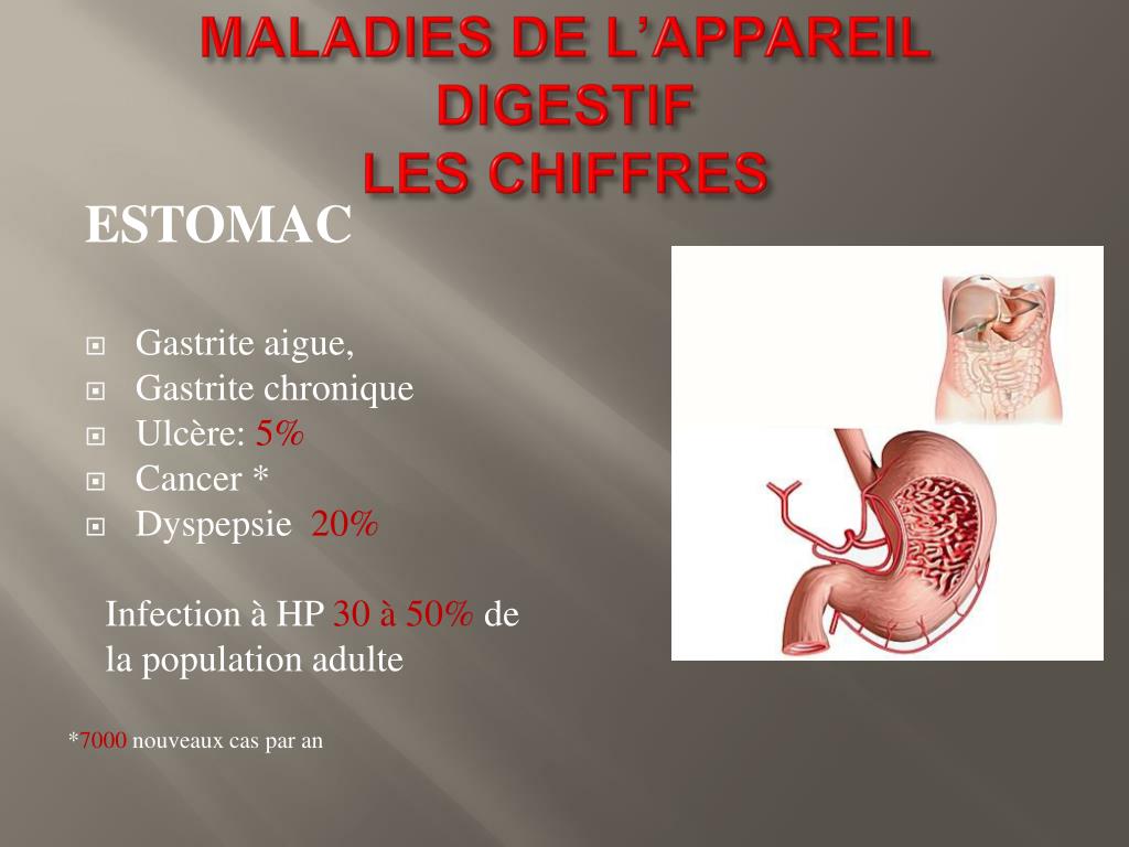 PPT - LES GASTRITES et gastropathies PowerPoint Presentation, free ...