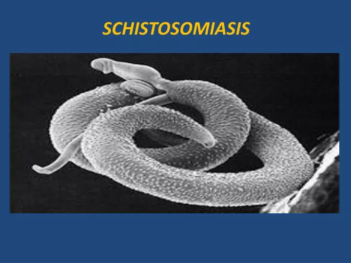 PPT - SCHISTOSOMIASIS PowerPoint Presentation, free download - ID:2001110