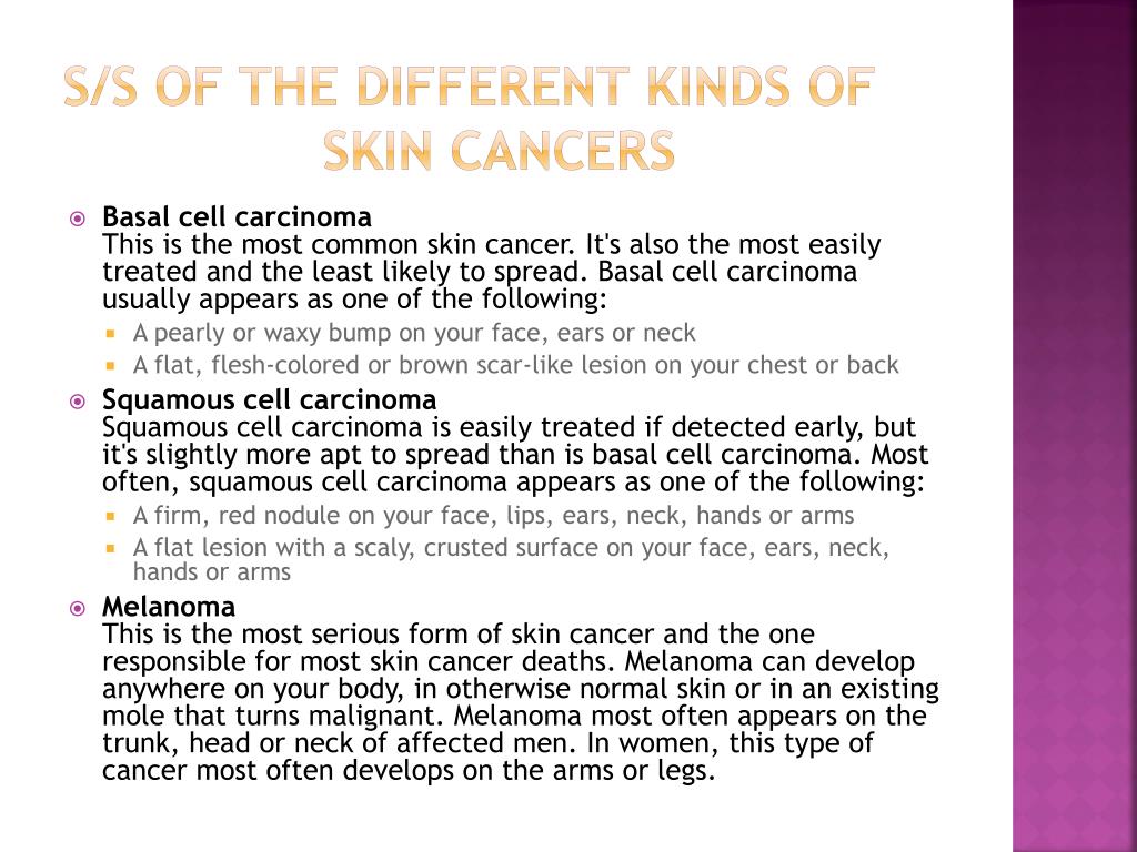 PPT - Skin cancer PowerPoint Presentation, free download - ID:2004426