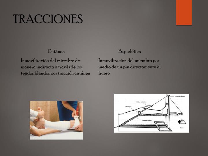 PPT ALTERACIONES DEL SISTEMA MUSCULO ESQUELÉTICO