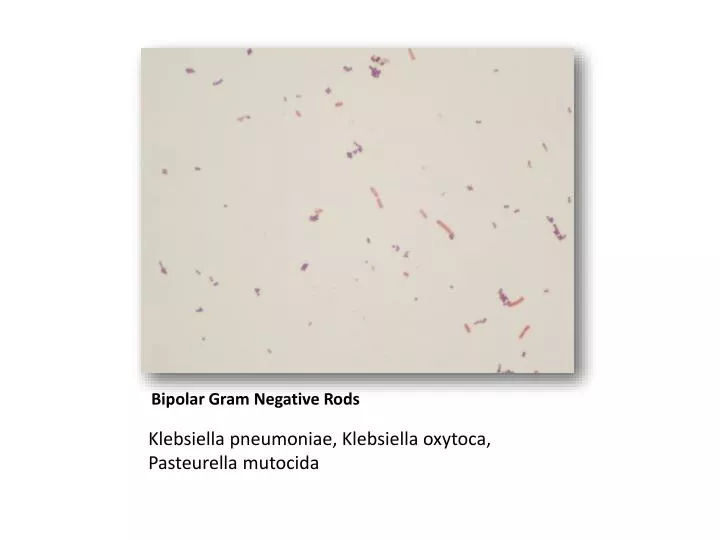 ppt bipolar gram negative rods powerpoint presentation klebsiella pneumoniae gram stain