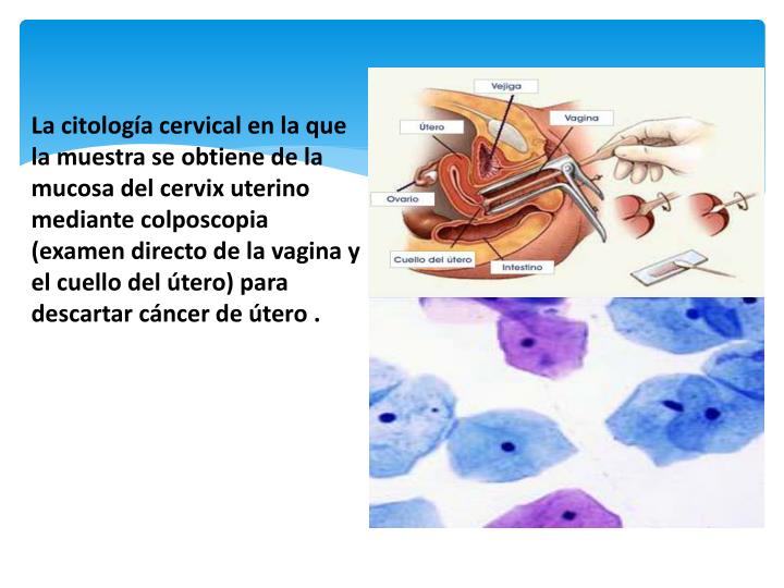 PPT - CITOLOGIA PowerPoint Presentation - ID:2005877