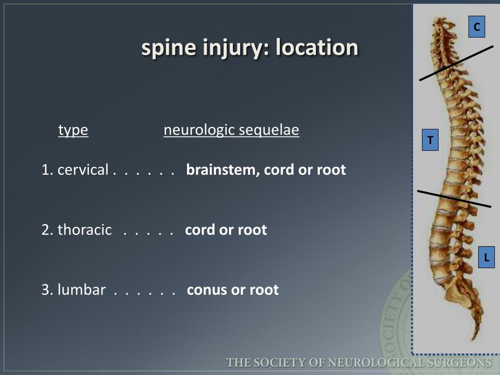 PPT - Emergency Spinal Radiological Assessment PowerPoint Presentation
