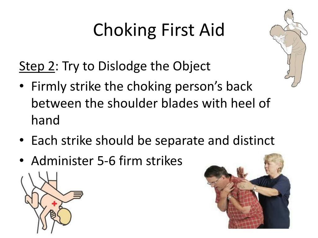 choking first aid presentation