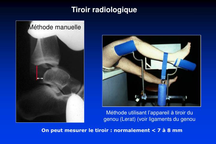 PPT Traumatologie De La Cheville PowerPoint Presentation ID 2020022 ppt-traumatologie-de-la-cheville-powerpoint-presentation-id-2020022