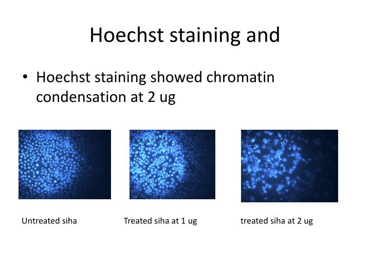 Hoechst Staining