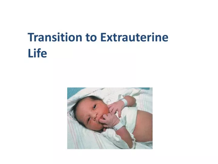 Ppt Transition To Extrauterine Life Powerpoint Presentation Free Download Id 2025572