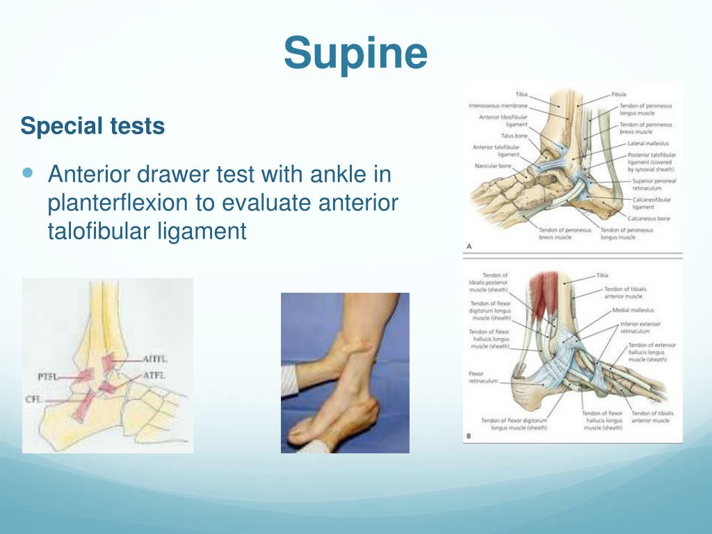 PPT - Foot and Ankle Examination PowerPoint Presentation, free download