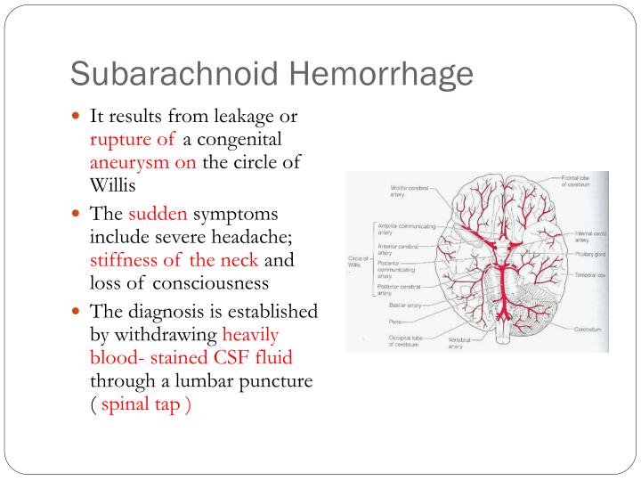 PPT - Blood Supply of Brain and Spinal Cord Lecture: 17 PowerPoint ...