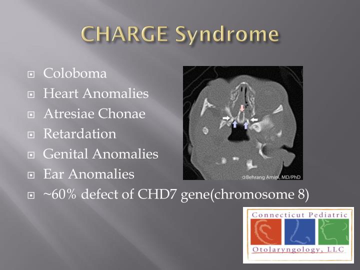 charge syndrome meaning charge syndrome meaning