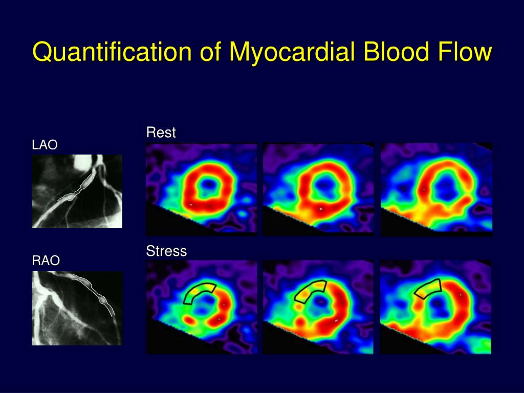 PPT - PET AND PET/CT IN ISCHEMIC HEART DISEASE PowerPoint Presentation ...